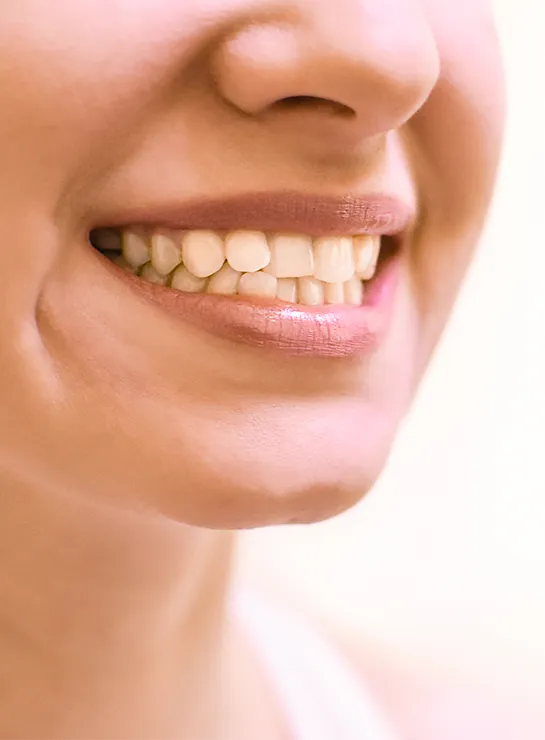 Ar turite problemų su dantų išvaizda (ortodintinių problemų)?